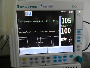 Splinternieuwe-anesthesie-monitoren,-die-met-de-nieuwste-technieken-werken-en-de-kleinste-afwijkingen--vroeg-signaleren